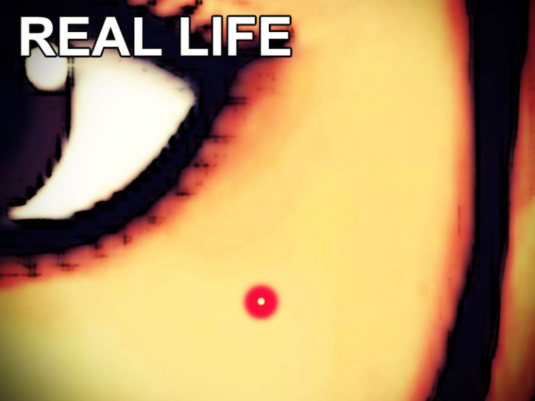 App zum Pickel ausdrücken